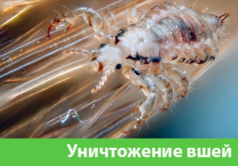 Уничтожение вшей в городе Дмитров